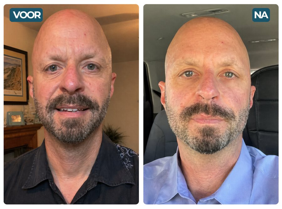 Zoran, 58 — prije / poslije
