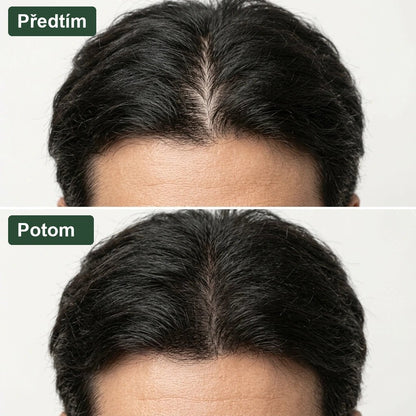 Předtím a potom