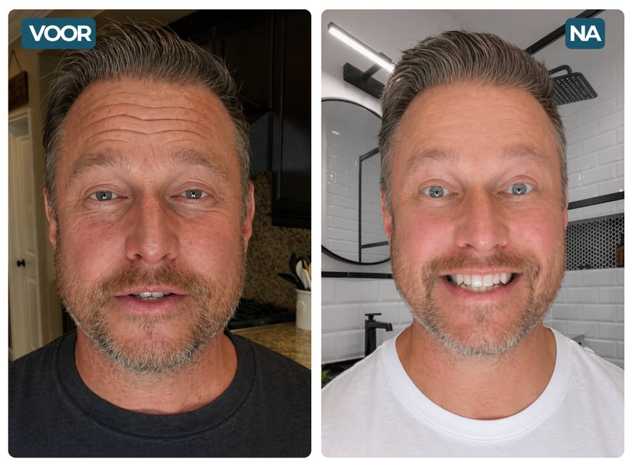 David, 49 — prije / poslije